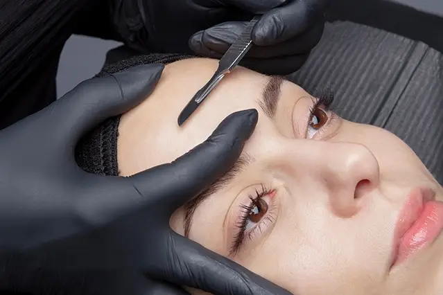 Person receiving dermaplaning treatment on their forehead by gloved hands.